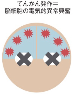 一過性意識消失(失神など) | くすり~の
