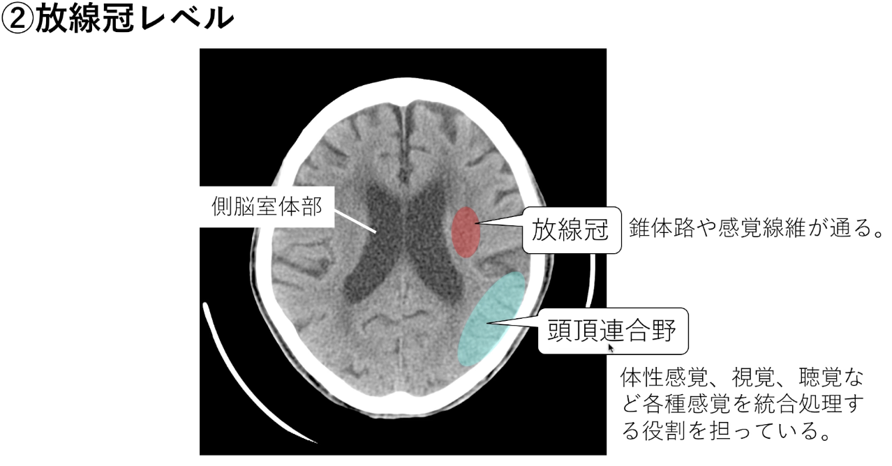 頭部CT・MRI | くすり~の