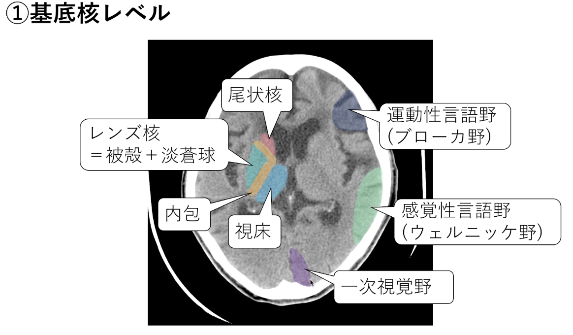 頭部CT・MRI | くすり~の